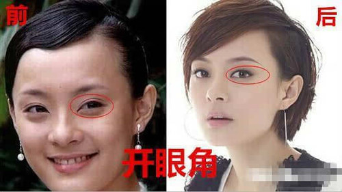 孫儷被導演贊用生命演戲,，這次孫儷自曝整過容，這算不算也是用生命在演戲,？