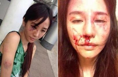 合肥女律師遭家暴 究竟有何深仇大恨挑斷妻子手筋腳筋,？(組圖)