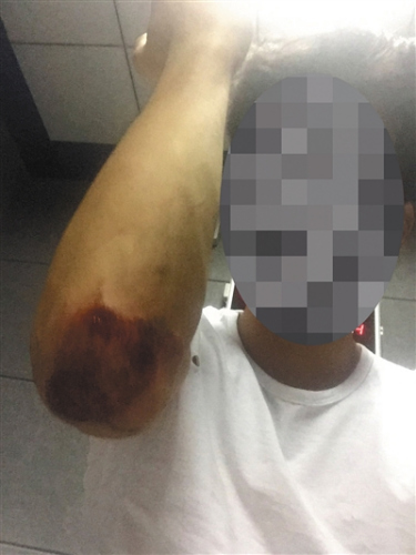 被警方抓捕時,，不知情的黃誠進行了反抗，導致胳膊肘擦傷,。