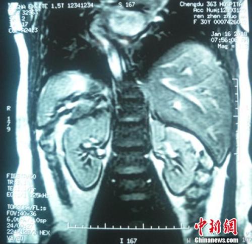 點(diǎn)擊進(jìn)入下一頁