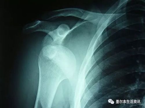小伙和父親正在庭院喝茶 突然一條鯊魚(yú)從天而降