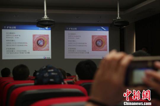 圖為民眾了解冠脈藥物球囊“輕舟？藥物球囊”的功效知識(shí),?！＄娦?攝
