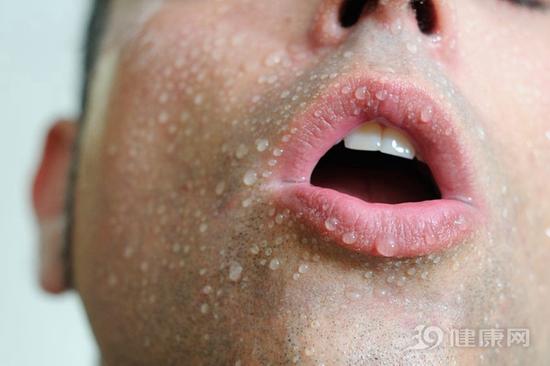 很容易出汗,？暗示身體“故障”了！