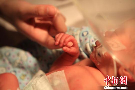 在一斤的喂養(yǎng)過程中,，醫(yī)院引入了“袋鼠式護(hù)理”模式：倡導(dǎo)并鼓勵媽媽母乳喂養(yǎng)，一斤順利獲得全腸內(nèi)營養(yǎng),?！≤窡?攝
