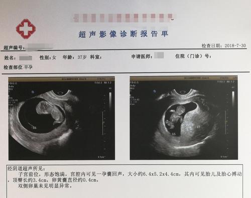 點(diǎn)擊進(jìn)入下一頁