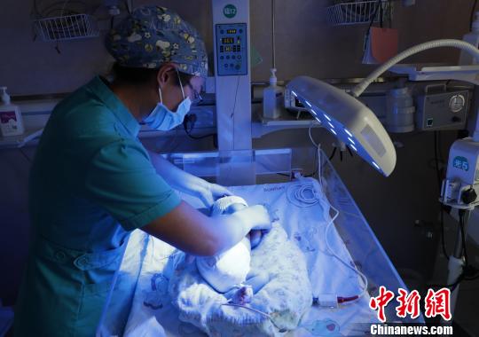 醫(yī)護人員對黃疸患兒進行護理,?！畹?攝